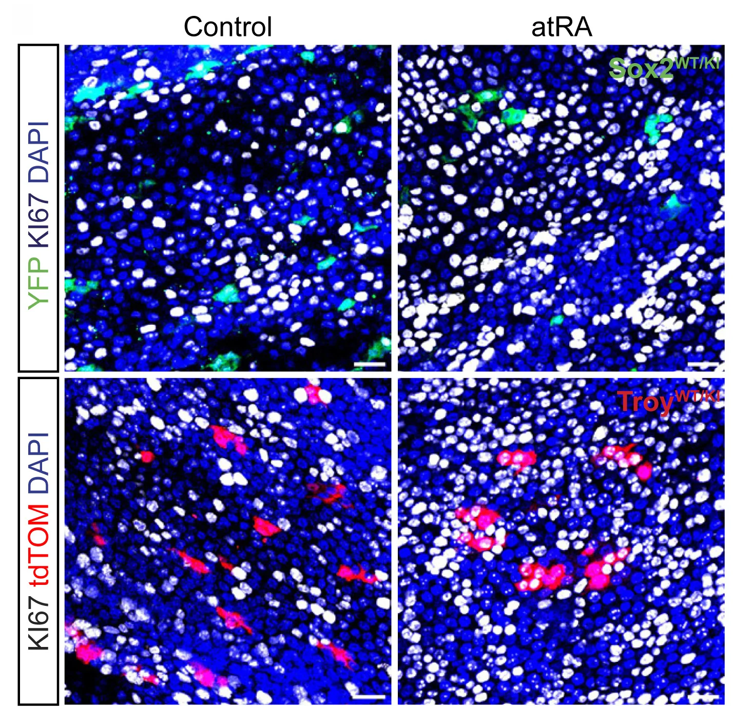 Open access visualization of Microscopy, Immunofluorescence, KI67, atRA-Treated Esophagi, Control Esophagi