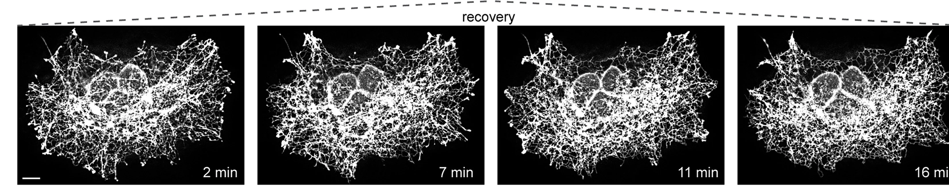 Open access visualization of Microscopy, ER Network, Mechanical Stress, Recovery, Blue Light