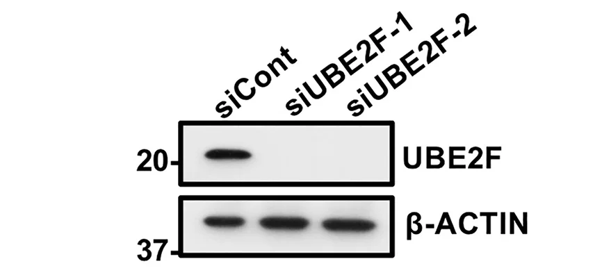 Open access visualization of Gel, PANC1 Cells, siRNAs, IB, UBE2F Knockdown