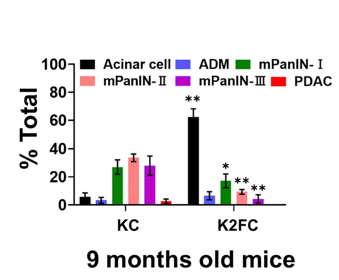 Open access visualization of Bar Plot, Error Bars, Clustered, Acinar Cells, ADM