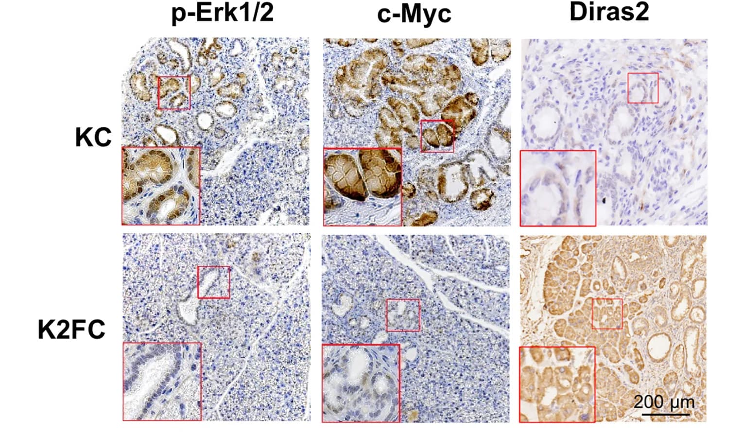 Open access visualization of Microscopy, IHC Staining, Immunoblot Analysis, Pancreas, Mouse