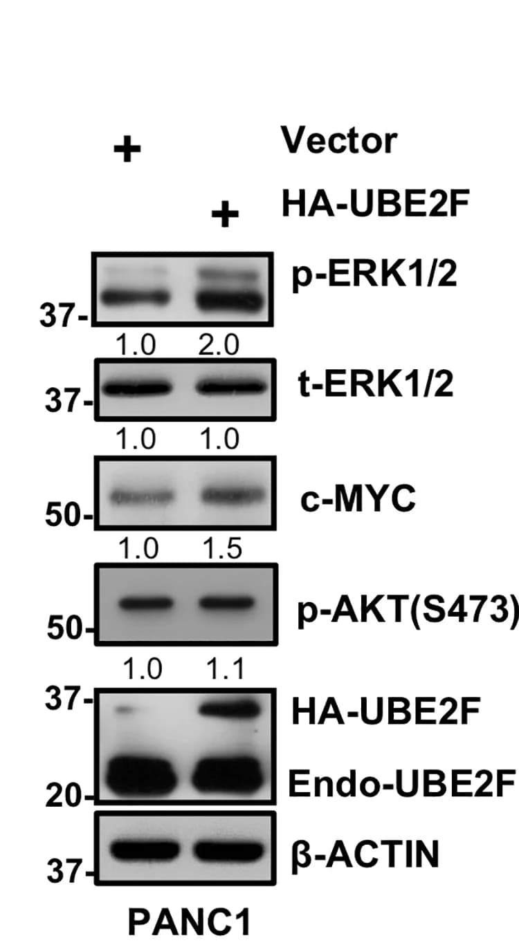 Open access visualization of Gel, UBE2F Knockdown, MAPK Signaling Pathway, PANC1 Cells, Constructs