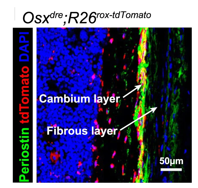 Open access visualization of Microscopy, Confocal Imaging, CL-PCs, tdTomato, Femurs