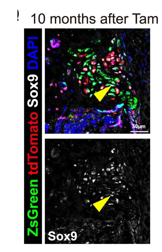 Open access visualization of Microscopy, Anti-Sox9, Immunostaining, ZsGreen Chondrogenic Cells, Perichondrium