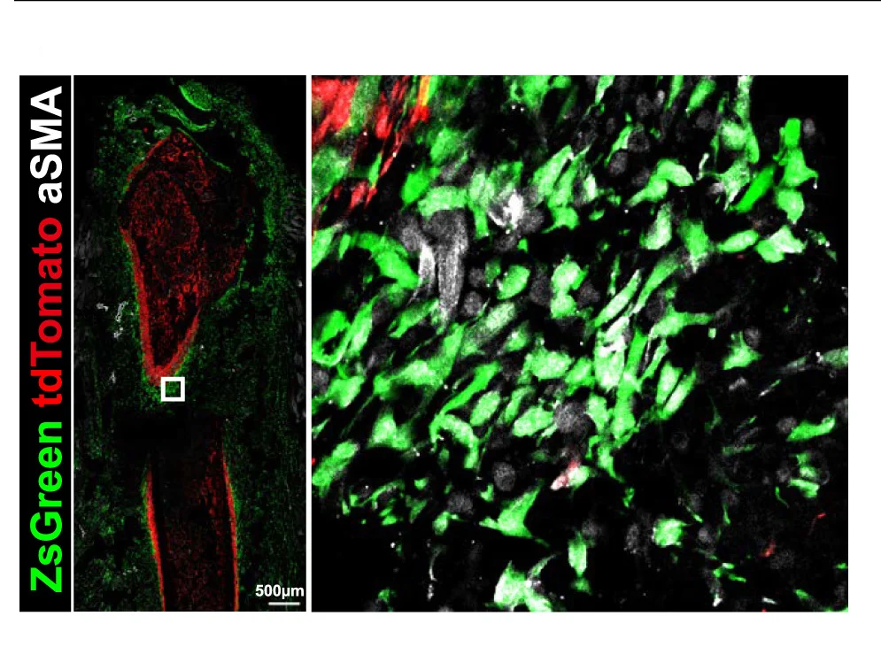 Open access visualization of Microscopy, Immunostaining, aSMA, Periosteal Cells, Fracture