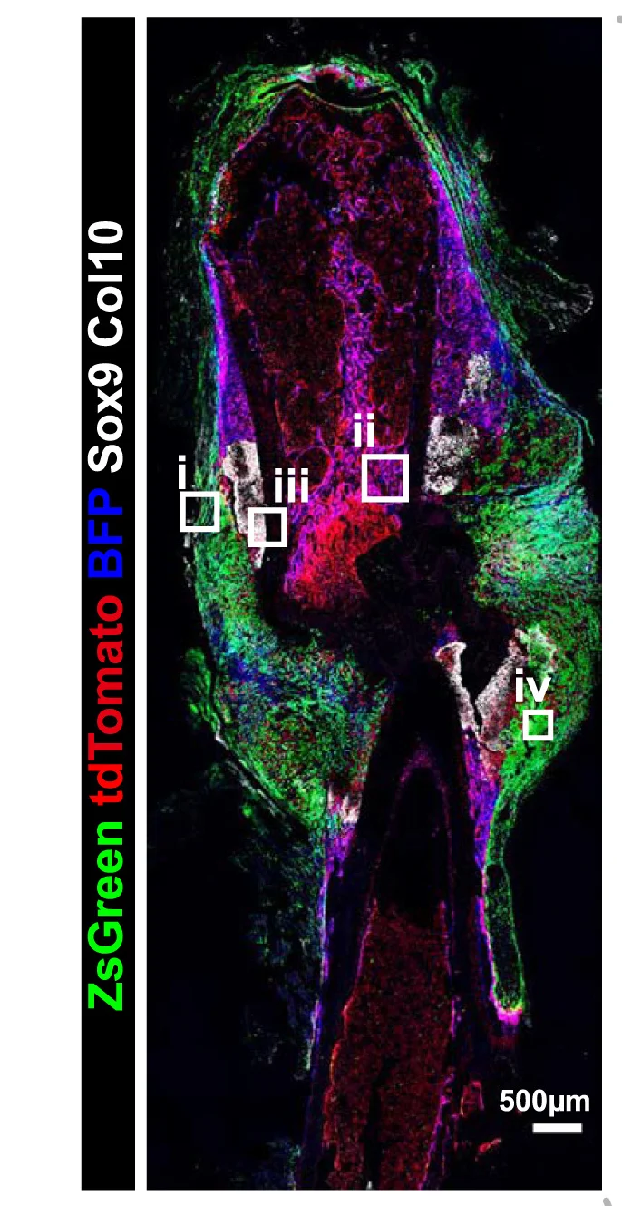 Open access visualization of Microscopy, Confocal Imaging, Femur, Fracture, Mice