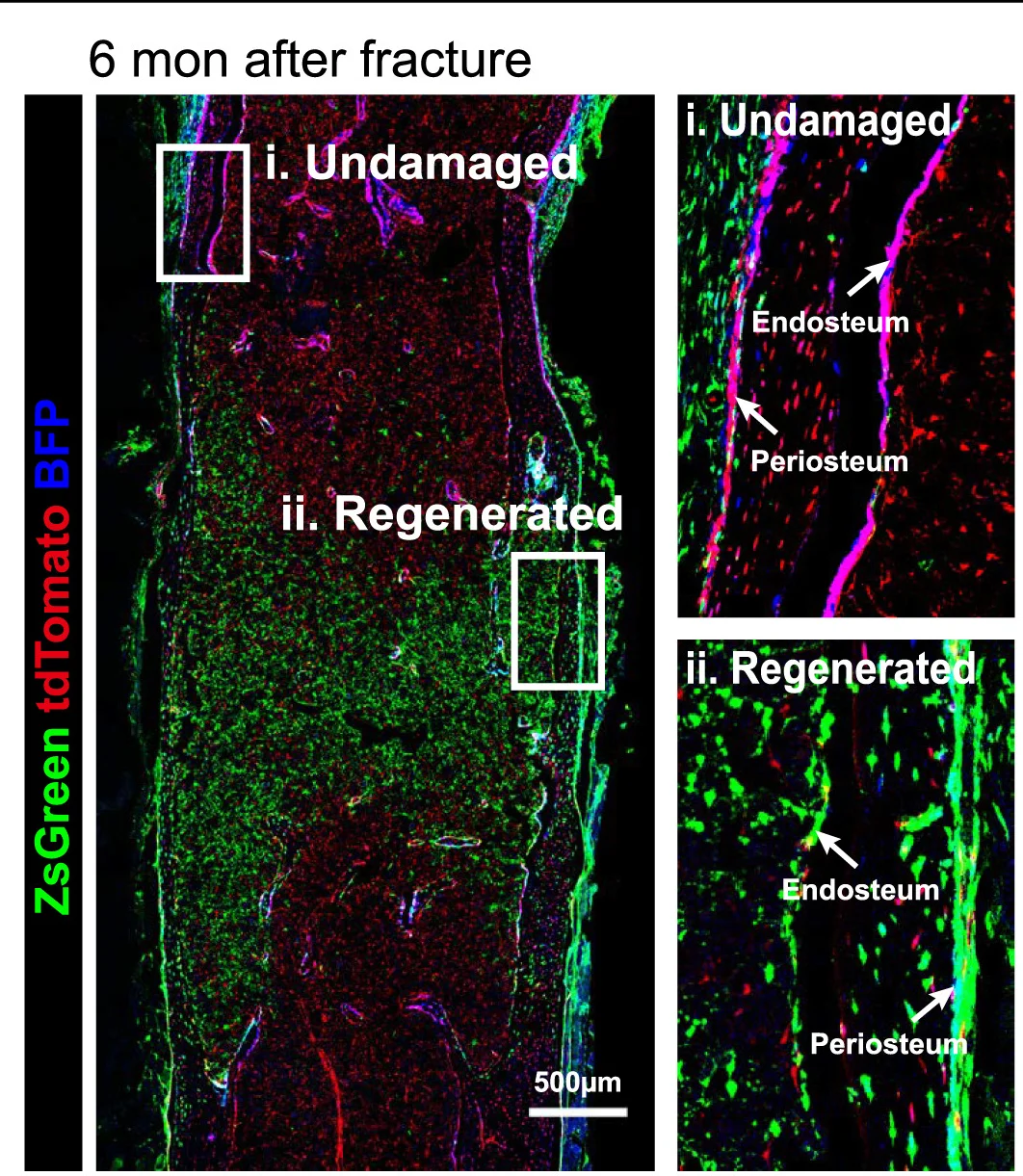 Open access visualization of Microscopy, Confocal Imaging, Cortical Bone, PdgfracreER;Osxdre;R26ZT1;Col1a1BFP Mice, Fracture
