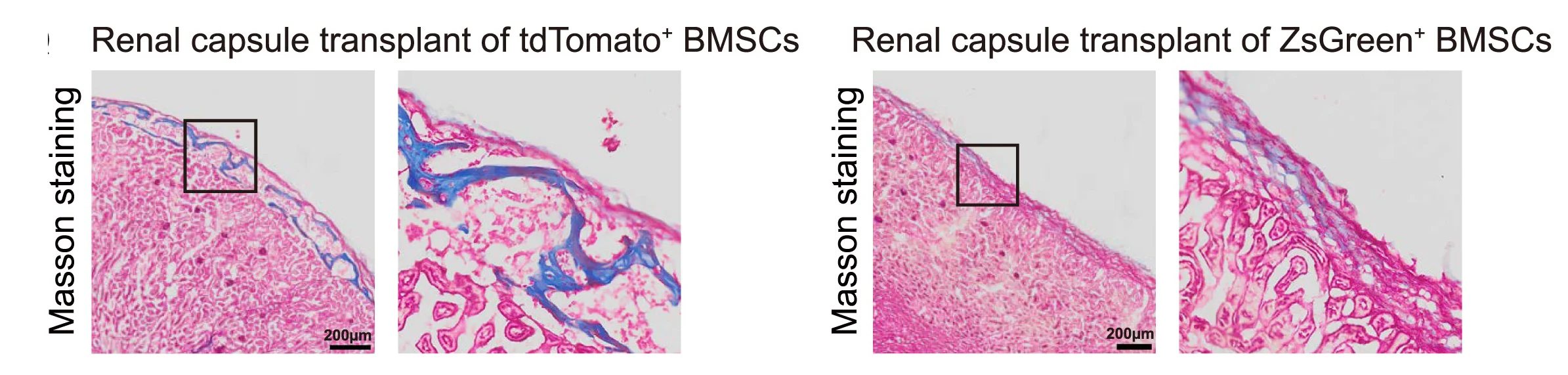 Open access visualization of Microscopy, Masson Trichrome Staining, In Vivo, Renal Capsule Transplants, ZsGreen