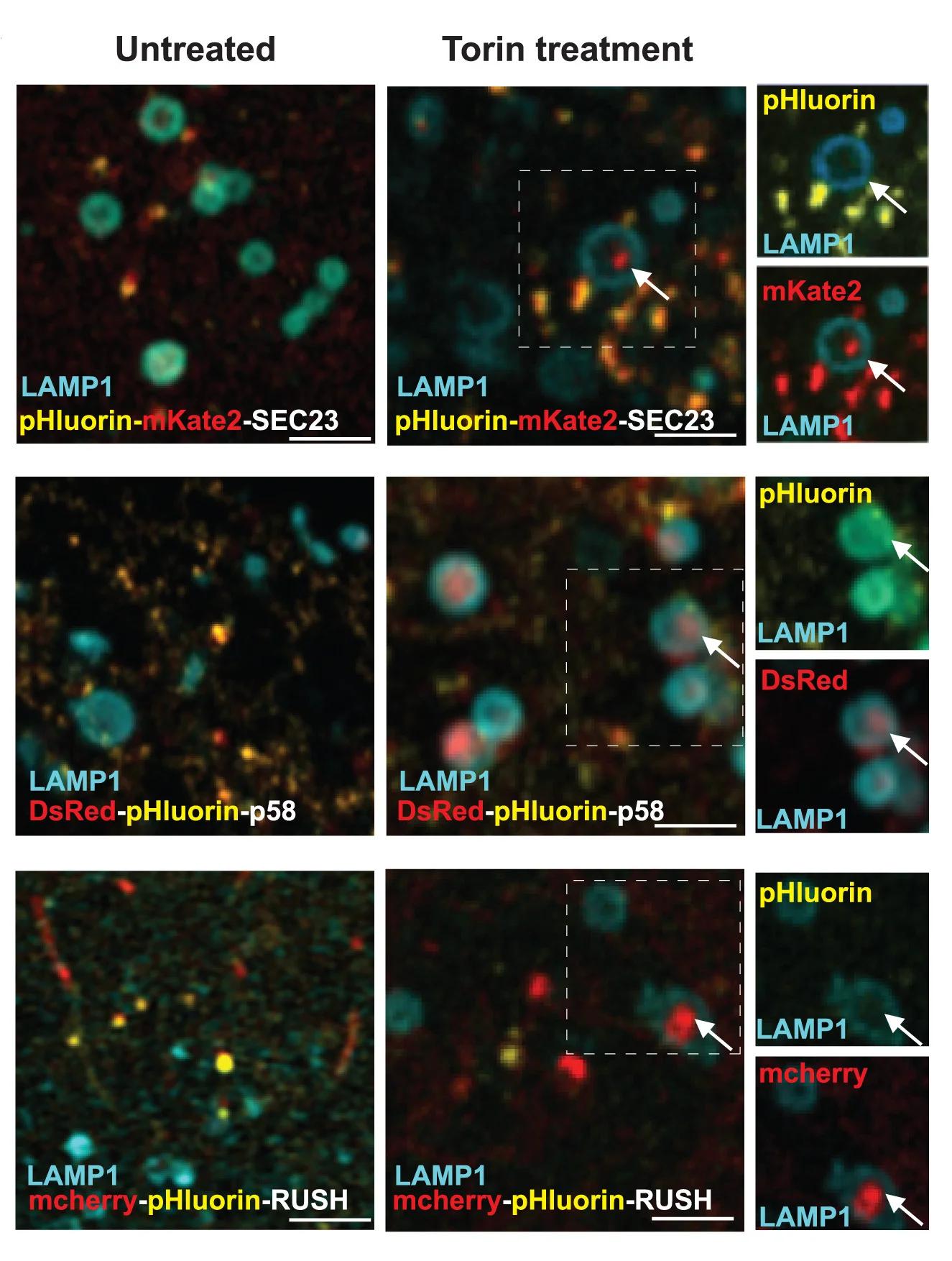 Open access visualization of Microscopy, U2OS Cells, pHluorin-mKate2-SEC23, dsRed-pHluorin-p58, TNF--SBP-mCherry-pHluorin