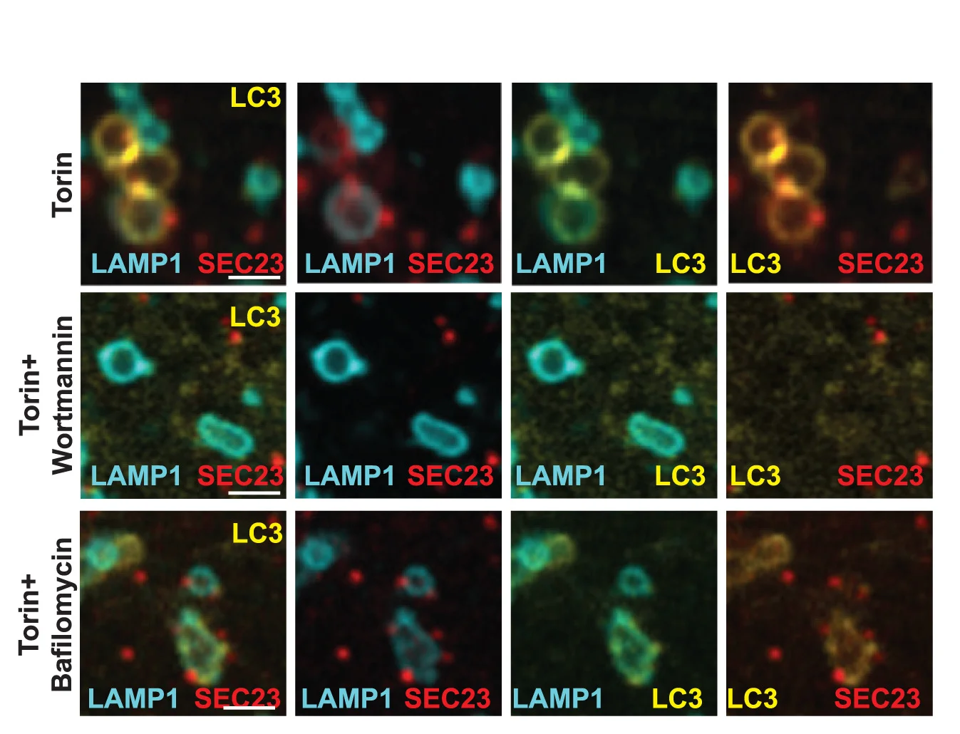 Open access visualization of Microscopy, U2OS Cells, LC3-GFP, mOrange2-SEC23, LAMP1-HaloTag