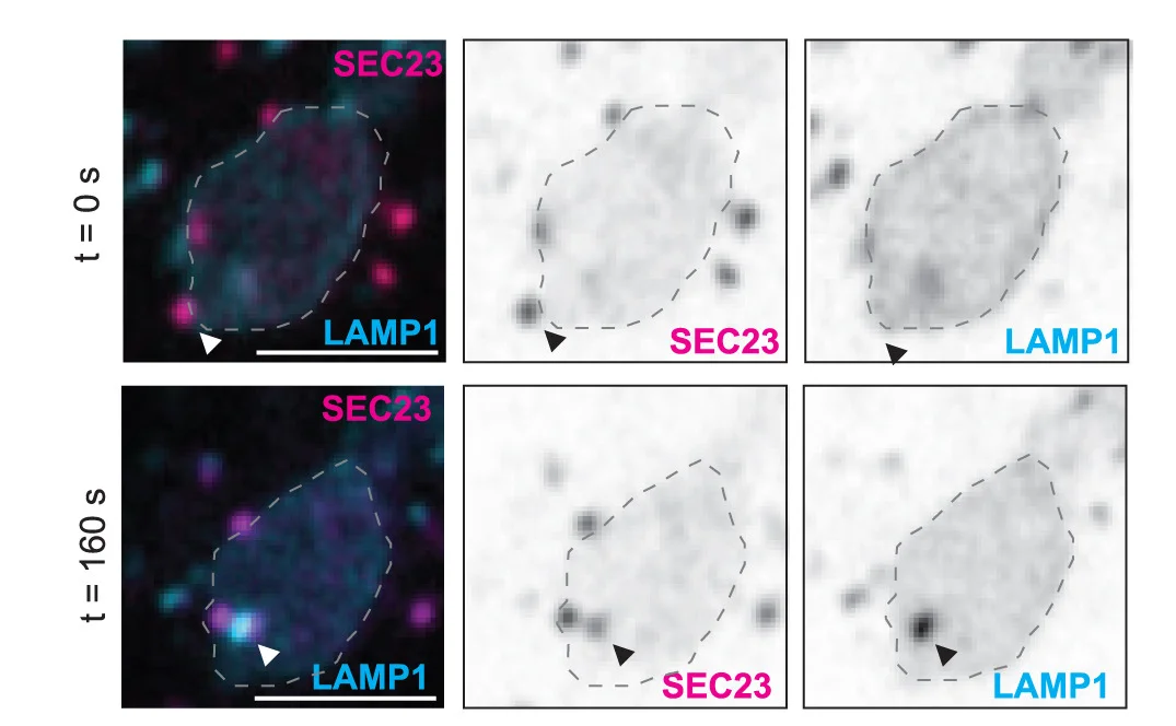 Open access visualization of Microscopy, Time-Lapse Images, SEC23, ERESs, LAMP1
