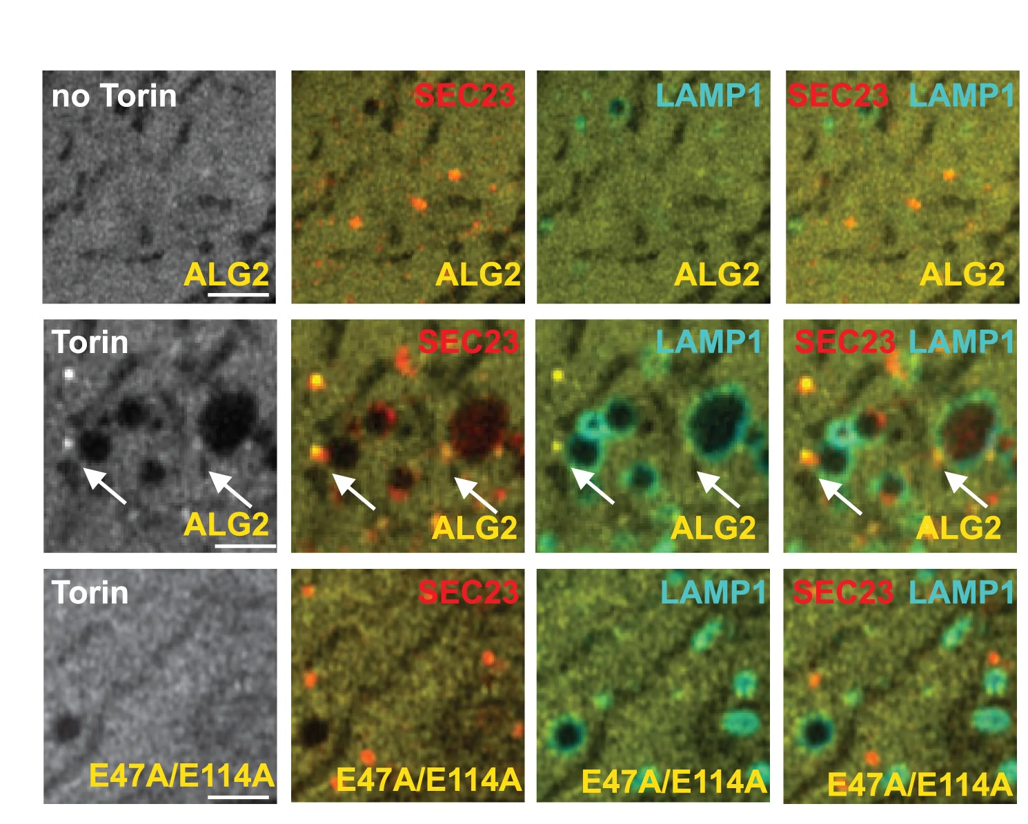 Open access visualization of Microscopy, U2OS Cells, mOrange2-SEC23, LAMP1-HaloTag, mEmerald-ALG2