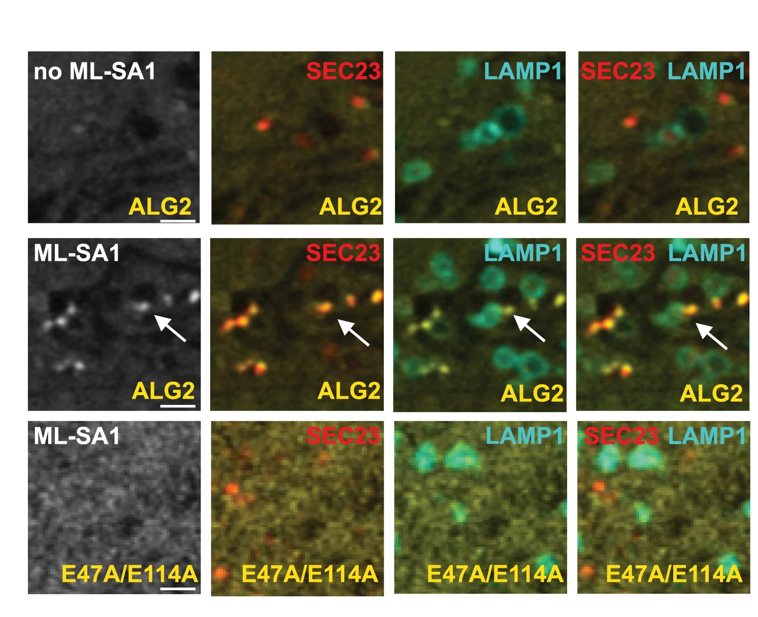 Open access visualization of Microscopy, U2OS Cells, mOrange2-SEC23, LAMP1-HaloTag, mEmerald-ALG2