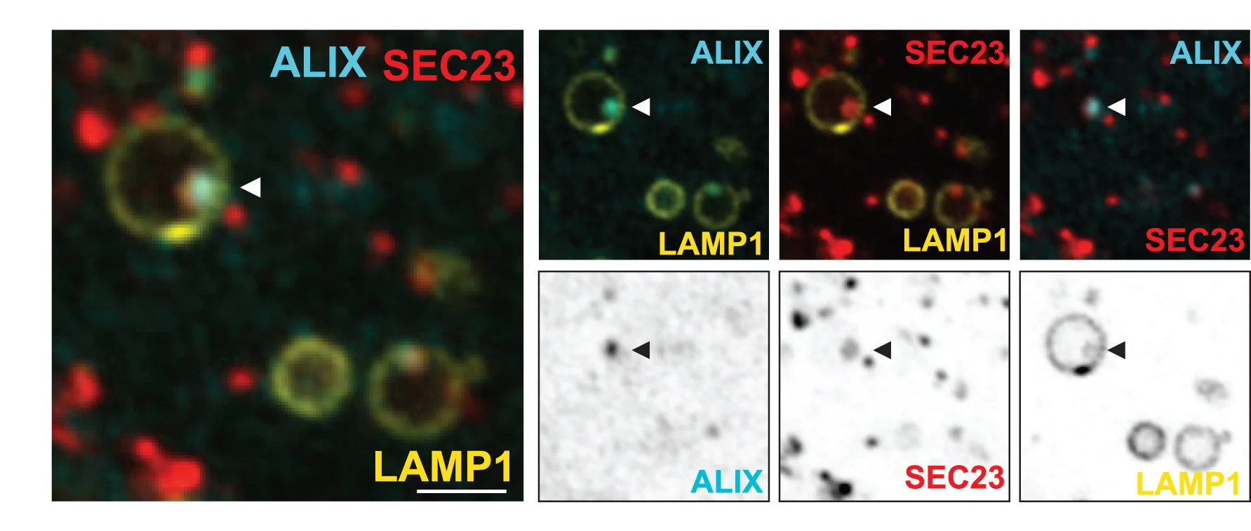 Open access visualization of Microscopy, U2OS Cells, mOrange2-SEC23, LAMP1-HaloTag, mEmerald-ALIX