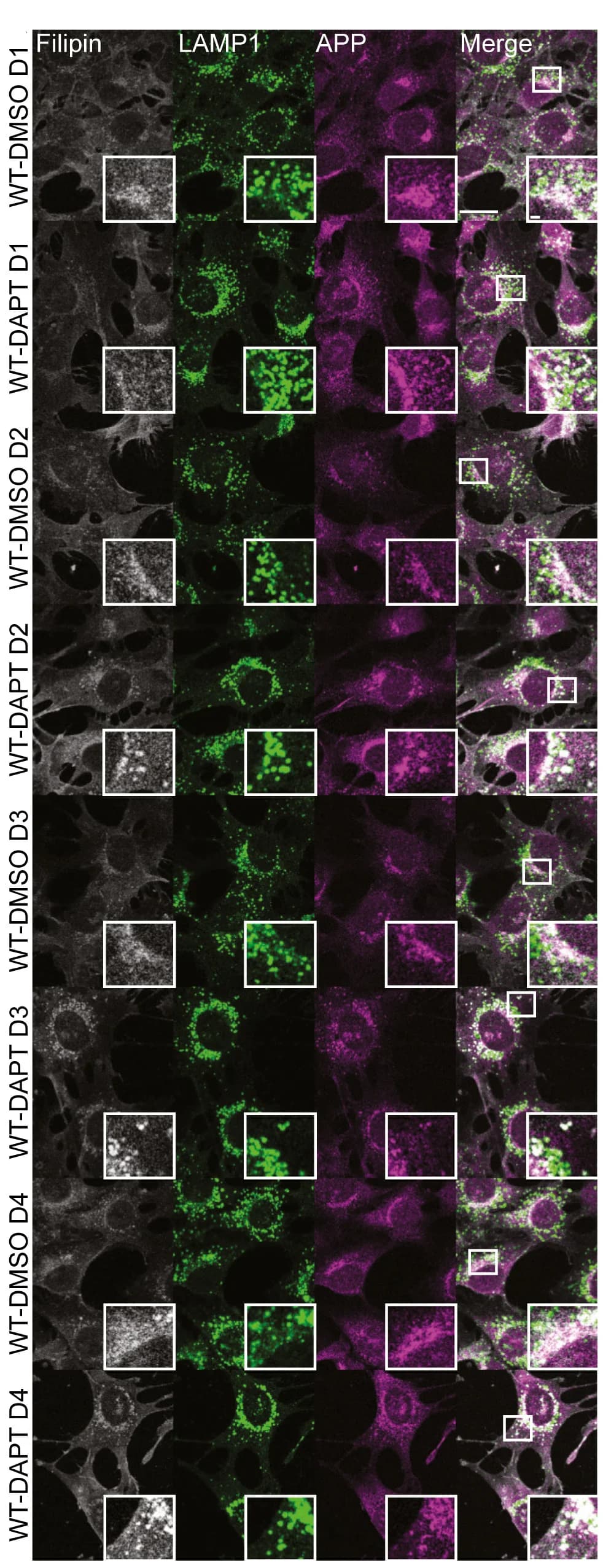 Open access visualization of Microscopy, Immunostaining, APP, LAMP1, Filipin