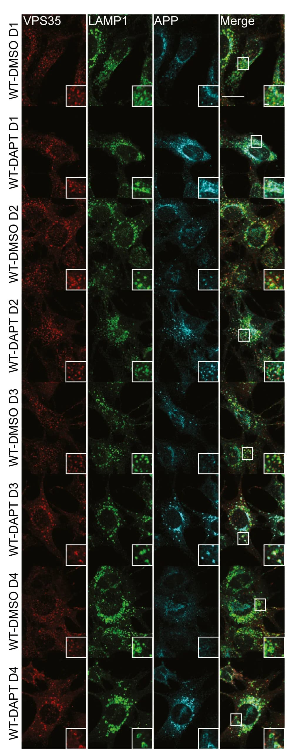 Open access visualization of Microscopy, Immunostaining, VPS35, LAMP1, APP