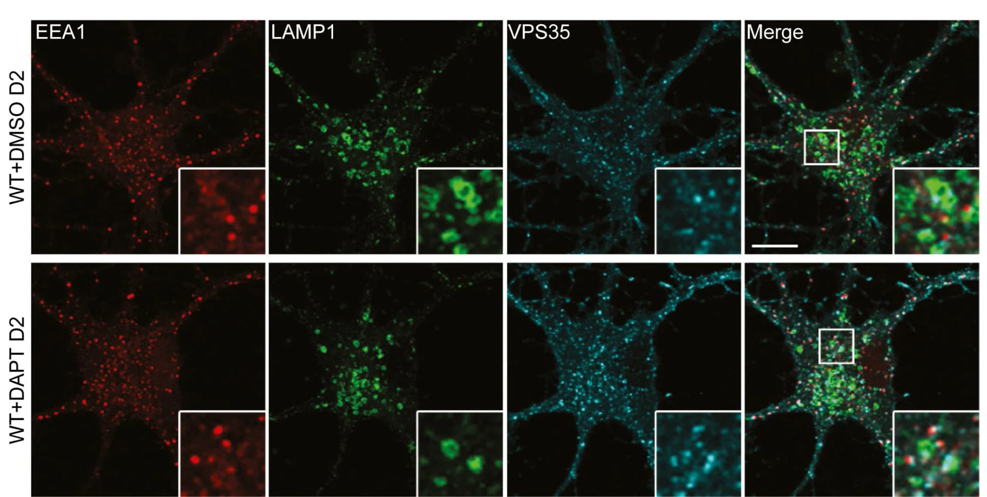 Open access visualization of Microscopy, Immunostaining, EEA1, LAMP1, VPS35