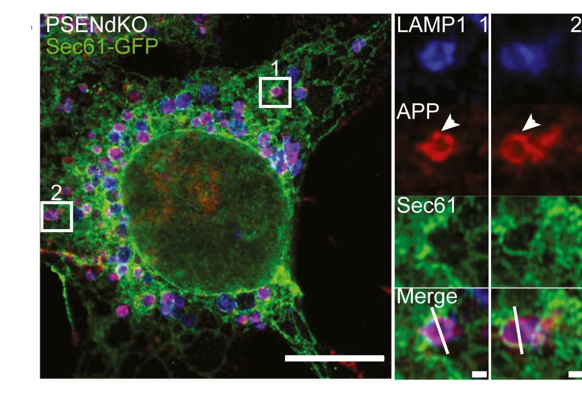Open access visualization of Microscopy, Immunostaining, LAMP1, APP, GFP-Sec61b Transfected Cells