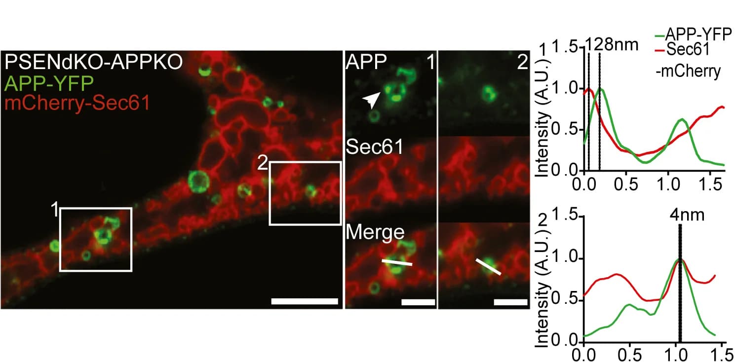 Open access visualization of Microscopy, Line Plot, Hypotonic Treatment, PSENdKO-APPKO Cells, mCherry-Sec61b