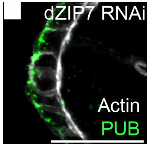 Open access visualization of Microscopy, Egg Chambers, Ubiquitinated Proteins, Immunostaining