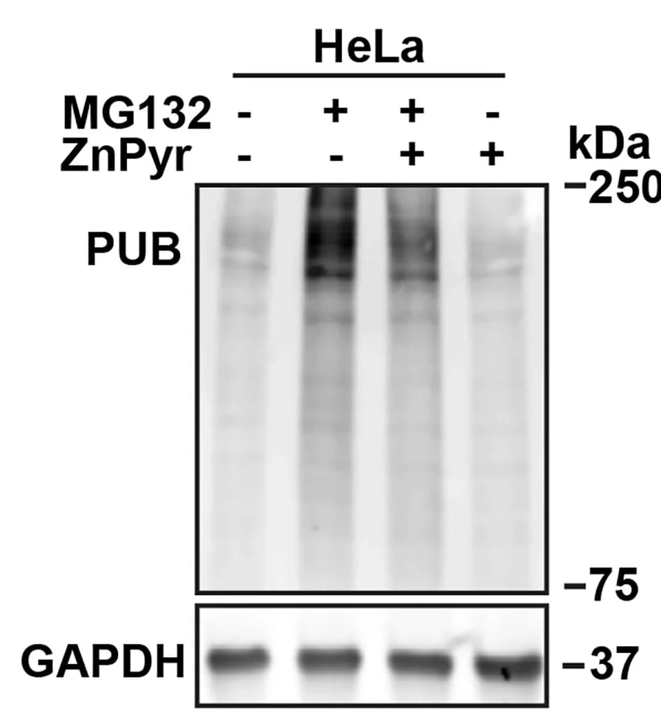 Open access visualization of Gel, Western Blot, HeLa Cells, Polyubiquitinated Protein, GAPDH