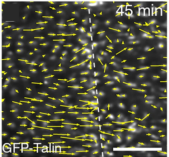 Open access visualization of Microscopy, Basal View, Time-Lapse Video, Eye-Antennal Discs, GFP-Talin