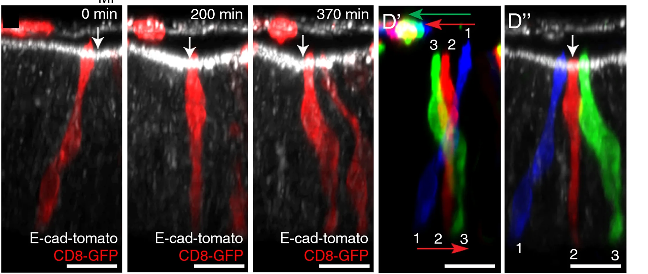 Open access visualization of Microscopy, Cross-Sectional View, Time-Lapse Video, Eye-Antennal Disc, E-cadherin-tomato