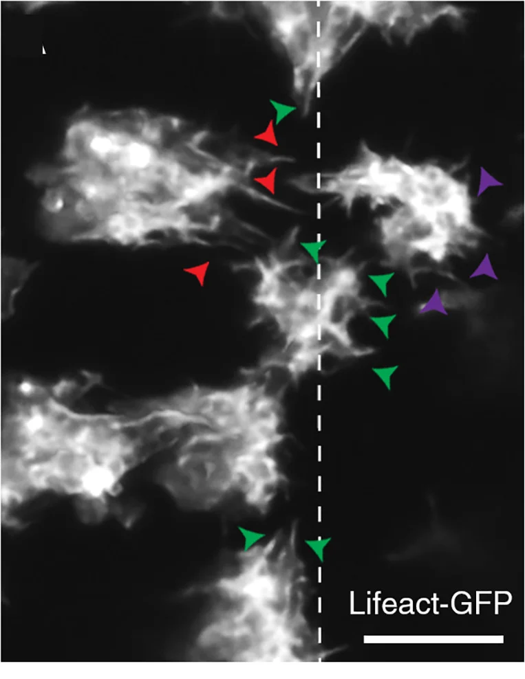 Open access visualization of Microscopy, Cells, Lifeact-GFP, Cell Protrusions, Morphogenetic Furrow