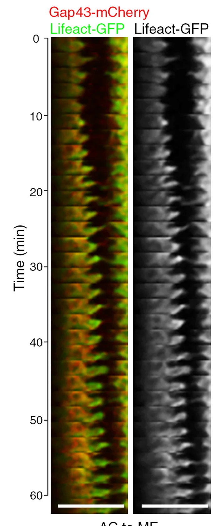 Open access visualization of Microscopy, Kymograms, Clones, Cells, Lifeact-GFP