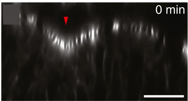 Open access visualization of Microscopy, Morphogenetic Furrow, Cross-Sectional Views, Eye-antennal Discs, Src42Ads-RNA