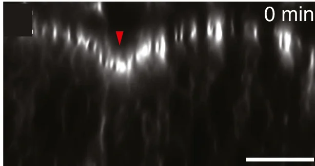 Open access visualization of Microscopy, Morphogenetic Furrow, Cross-Sectional Views, Eye-antennal Discs, Src42Ads-RNA