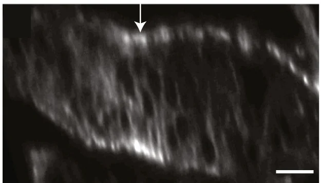 Open access visualization of Microscopy, Eye-Antennal Disc, paRacT17N, Clones of Cells, Photoactivation