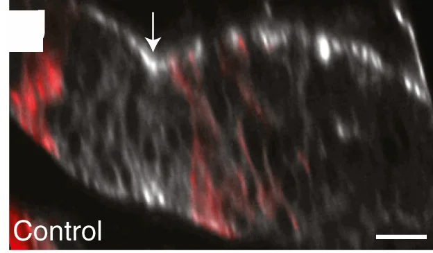 Open access visualization of Microscopy, Eye-Antennal Disc, paRacT17N, Clones of Cells, Photoactivation
