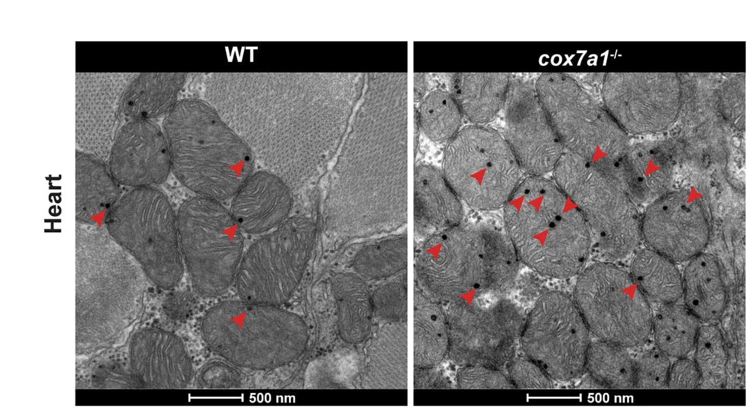 Open access visualization of Microscopy, Transmission Electron Microscopy, Cardiac Muscle, Mitochondria, Calcium Precipitates
