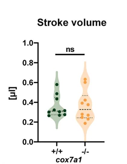 Open access visualization of Violin Plot, Box Plot, Stroke Volume, Echocardiography, Cardiac Function