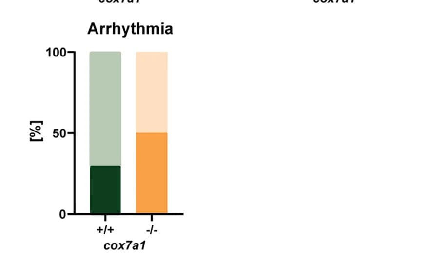 Open access visualization of Stacked Bar Plot, Arrhythmias, Echocardiography, Cardiac Function