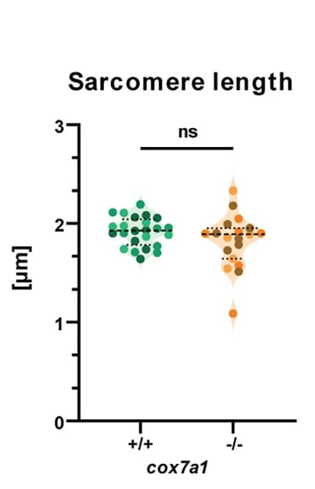 Open access visualization of Violin Plot, Scatter Plot, Sarcomere Length, Transmission Electron Microscopy, Cardiac Muscle