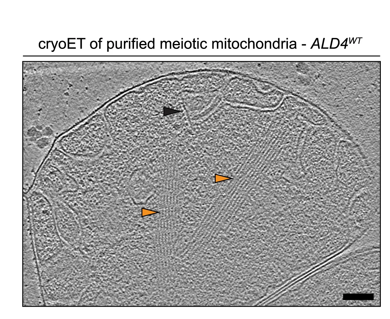 Open access visualization of Microscopy, Cryo-tomogram, Mitochondrion, Ald4, Filament Arrays