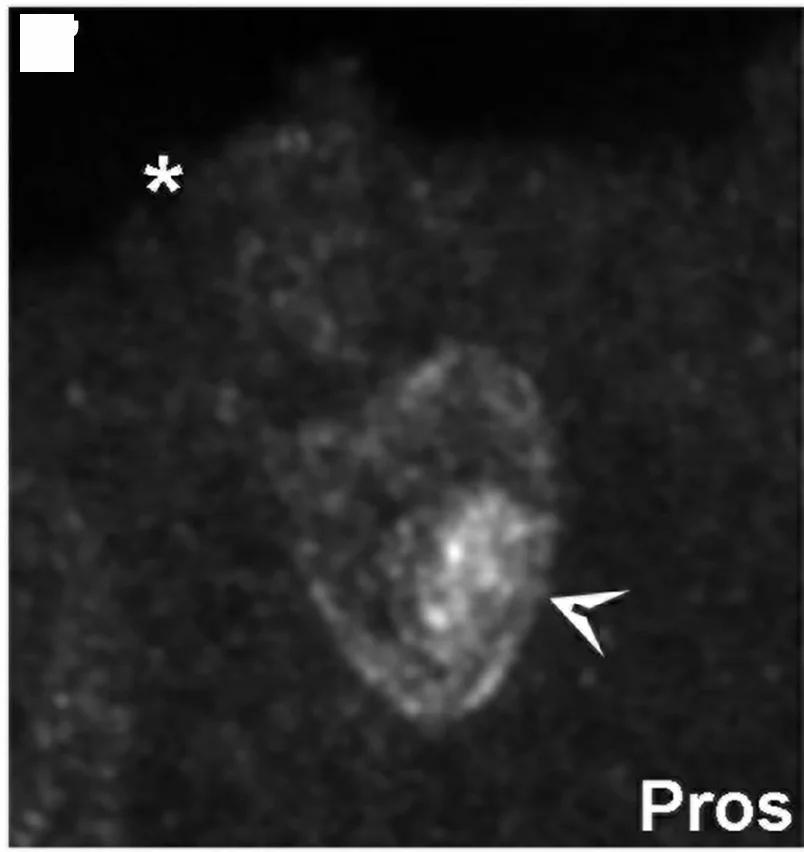 Open access visualization of Microscopy, Immunofluorescence, GFP, Pros, Fkh
