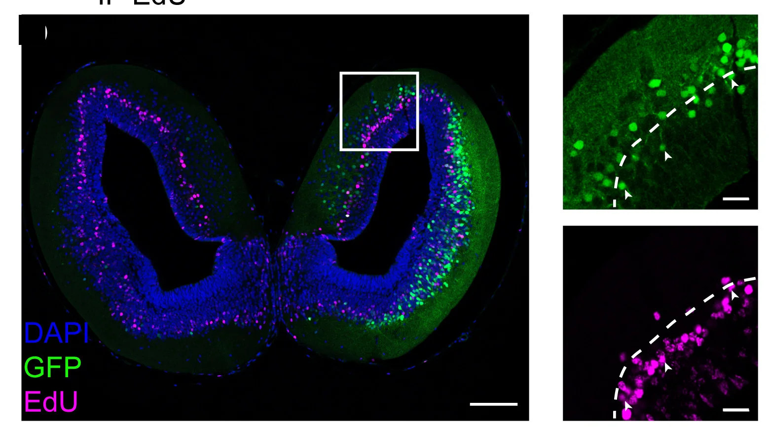 Open access visualization of Microscopy, Coronal Section, Telencephalon, Pre-Metamorphic Larva, EdU+ Cells