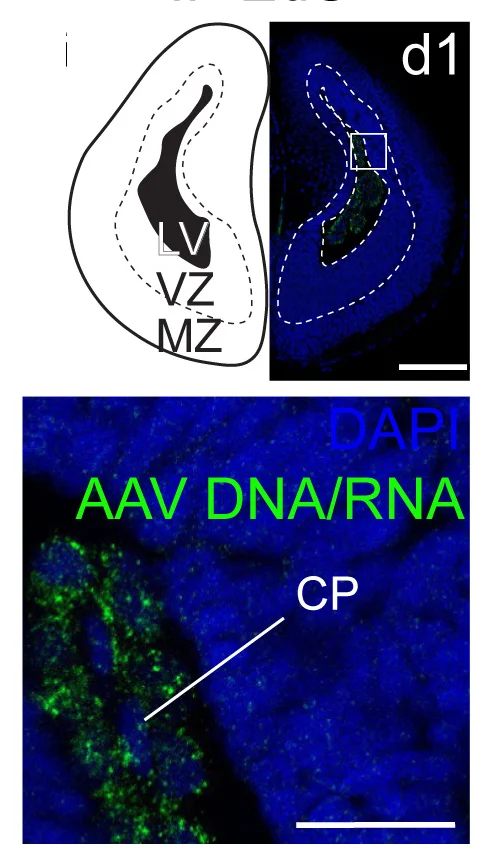 Open access visualization of Microscopy, Illustration, Coronal Section, Pleurodeles Telencephalon, Viral DNA/RNA