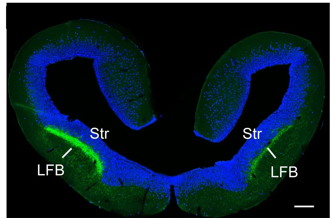 Open access visualization of Microscopy, Coronal Sections, Anterior-Posterior Axis, GFP Expression, Injection Site