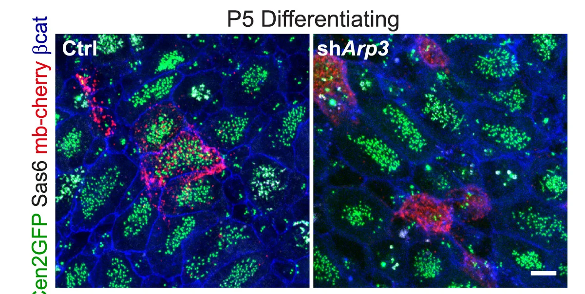 Open access visualization of Microscopy, Centrin2-GFP, Sas6, mb-cherry, Transfection Reporter