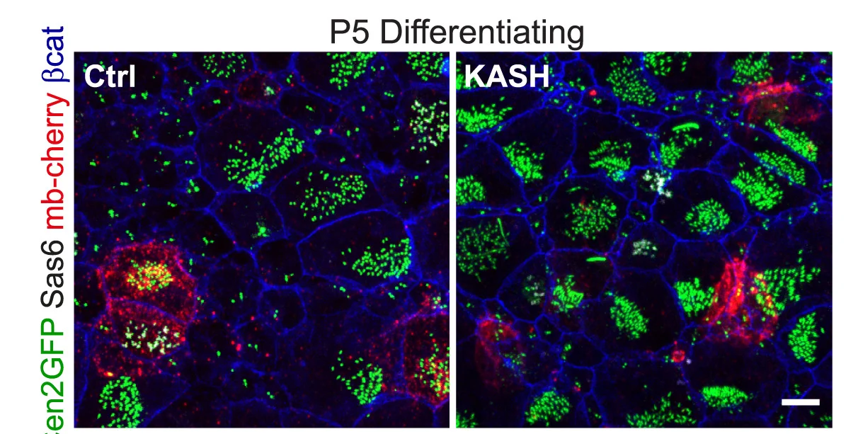 Open access visualization of Microscopy, Centrin2-GFP, Sas6, mb-cherry, Beta-catenin