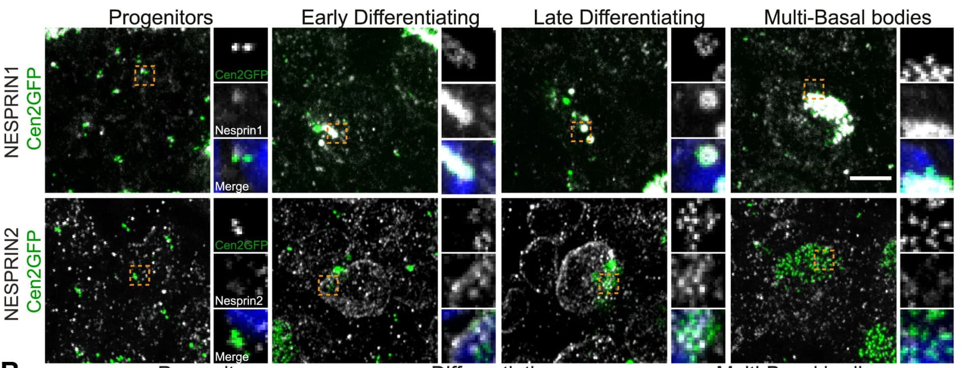 Open access visualization of Microscopy, NESPRIN1, NESPRIN2, Centrin2-GFP, EC Differentiation