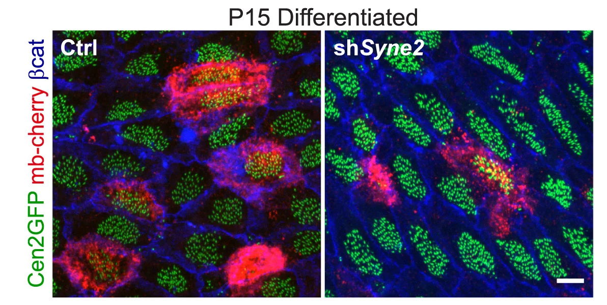 Open access visualization of Microscopy, Centrin2-GFP, Mb-Cherry, Beta-Catenin, Differentiated Cells