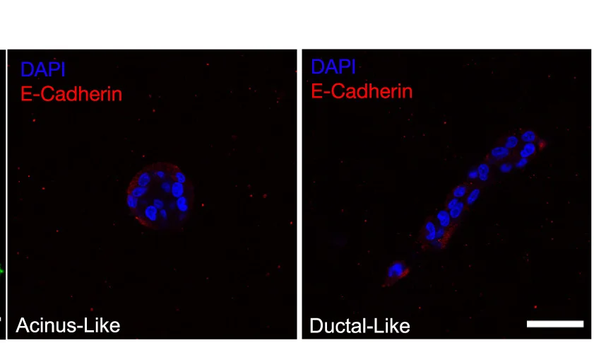 Open access visualization of Microscopy, E-cadherin, MDA-MB-231, Acinus-like Structures, Ductal-like Structures