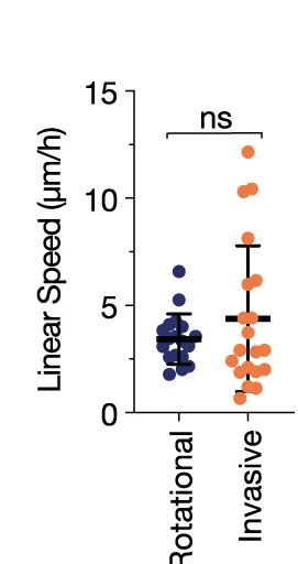 Open access visualization of Scatter Plot, Error Bars, Rectilinear Speed, Cellular Track, Invasive Cells