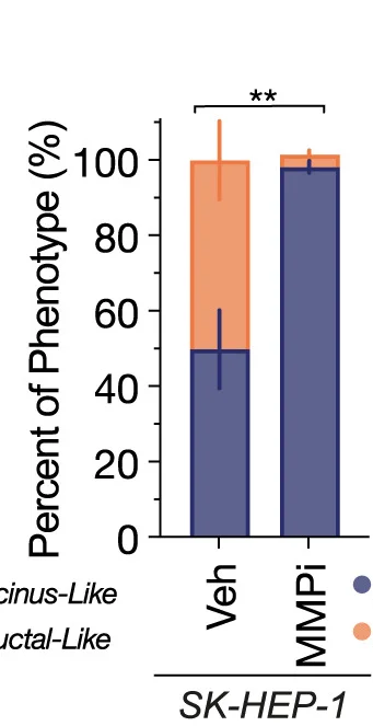 Open access visualization of Stacked Bar Plot, Error Bars, Ductal-like Morphologies, Acinus-like Morphologies, Vehicle