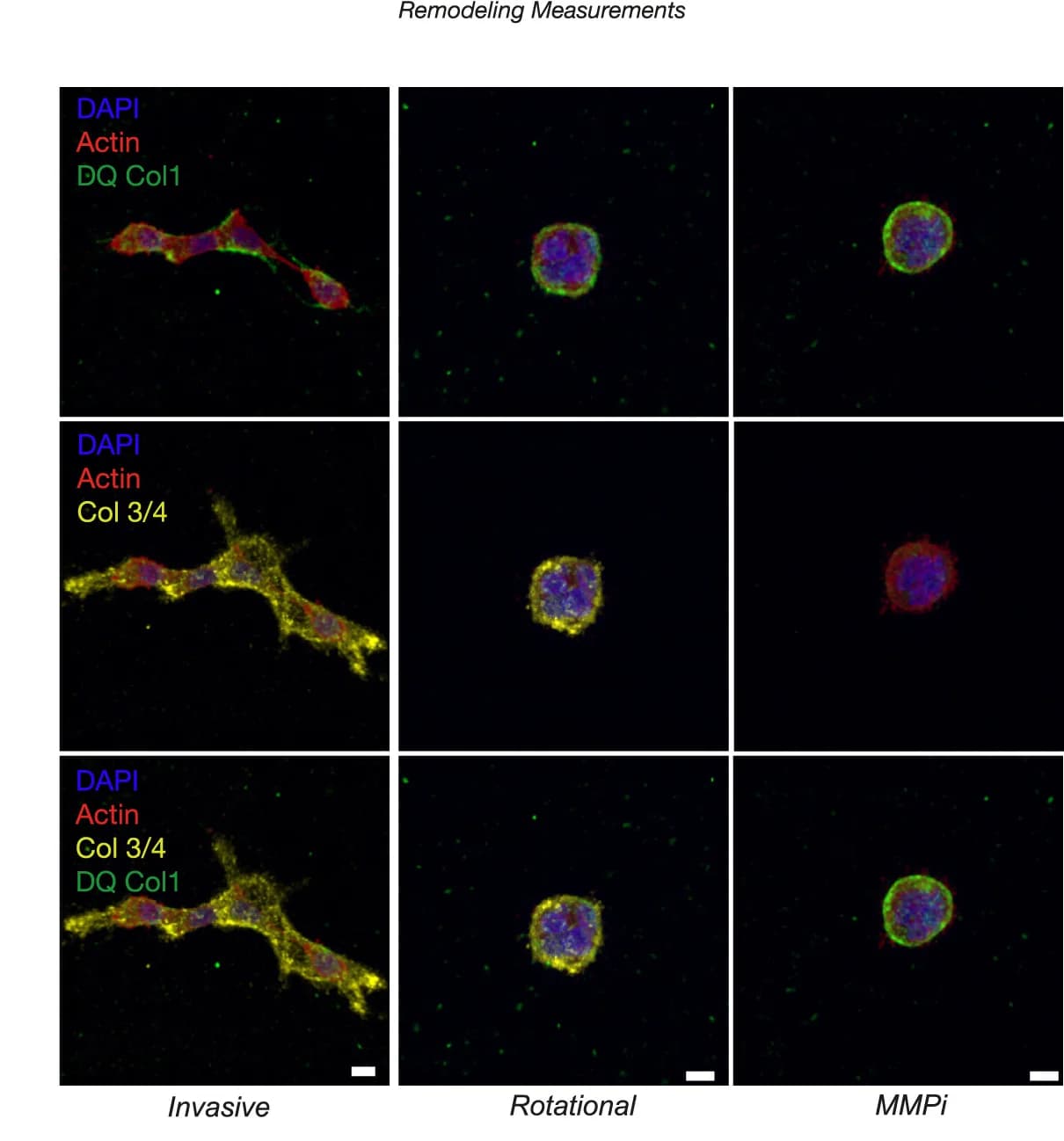 Open access visualization of Microscopy, Fluorescent Micrographs, Matrix Remodeling, Vehicle, MMPi